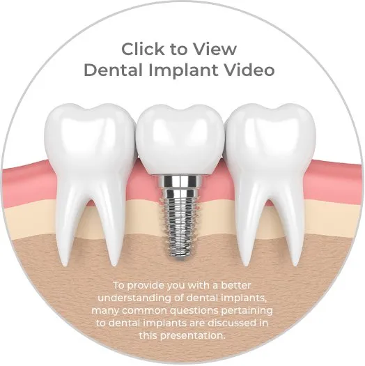 To provide you with a better understanding of dental implants, many common questions pertaining to dental implants are discussed in this presentation.